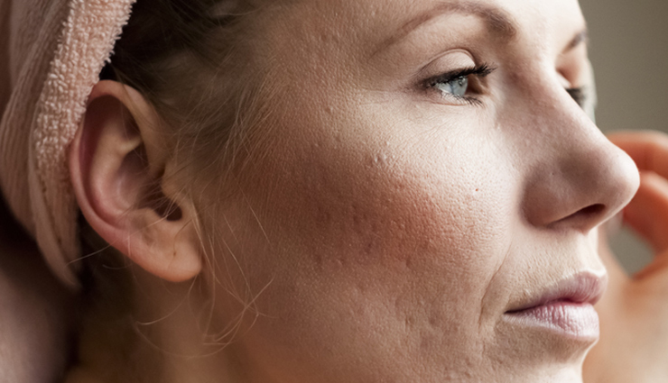 benefits of using almond oil makeup remover,beauty tips,beauty hacks