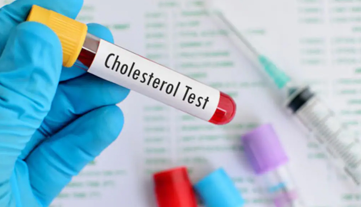 health benefits of almonds,Almonds,Health tips,fitness tips