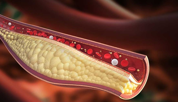 Almonds,health benefits of almonds,Health tips,fitness tips