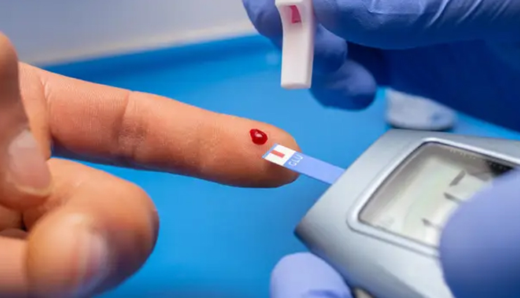 aloe vera,health benefits of aloe vera,Health tips,fitness tips