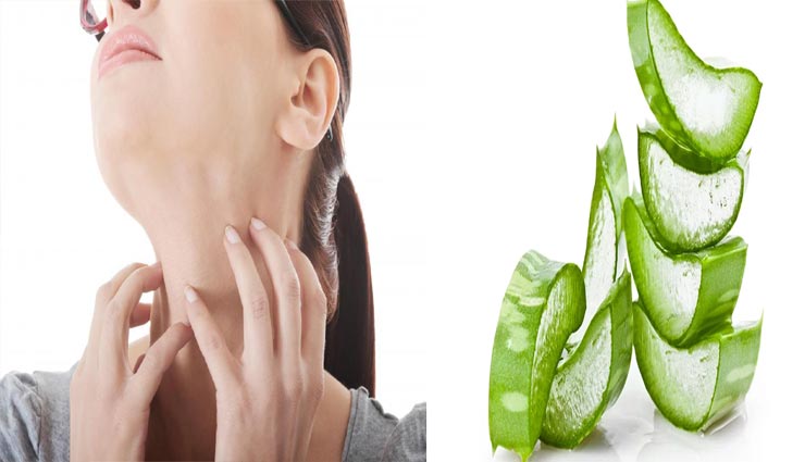 Health tips,health tips in hindi,ringworm,ringworm remedies,home remedies,remedies of ringworm