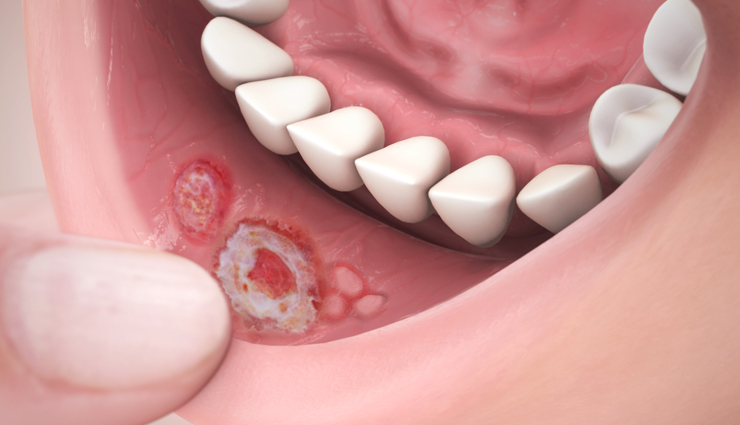 aloe vera juice benefits,drinking aloe vera juice advantages,benefits of aloe vera juice consumption,health benefits of aloe vera juice,aloe vera juice for health benefits,aloe vera juice advantages for body,why drink aloe vera juice,aloe vera juice health benefits list,aloe vera juice benefits for wellness,aloe vera juice properties and benefits,aloe vera juice for skin and hair,aloe vera juice health properties,aloe vera juice nutritional benefits,drinking aloe vera juice advantages,aloe vera juice for digestion,aloe vera juice for immune system,aloe vera juice and health improvement,aloe vera juice for detoxification,aloe vera juice antioxidants,aloe vera juice for gastrointestinal health