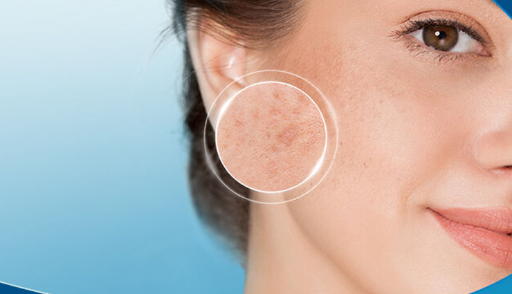 बालों के साथ स्किन को भी फायदा पहुंचाता हैं एलोवेरा ऑयल, जानें इसके बारे में aloe vera oil benefits for skin and hair,benefits of aloe vera oil for skincare and haircare,amazing benefits of aloe vera oil for skin and hair,aloe vera oil advantages for skin and hair health,aloe vera oil uses for skin and hair improvement,how aloe vera oil benefits skin and hair,aloe vera oil benefits and uses for skin and hair,enhancing skin and hair with aloe vera oil benefits,aloe vera oil properties for skin and hair enhancement,aloe vera oil benefits: skin and hair revitalization