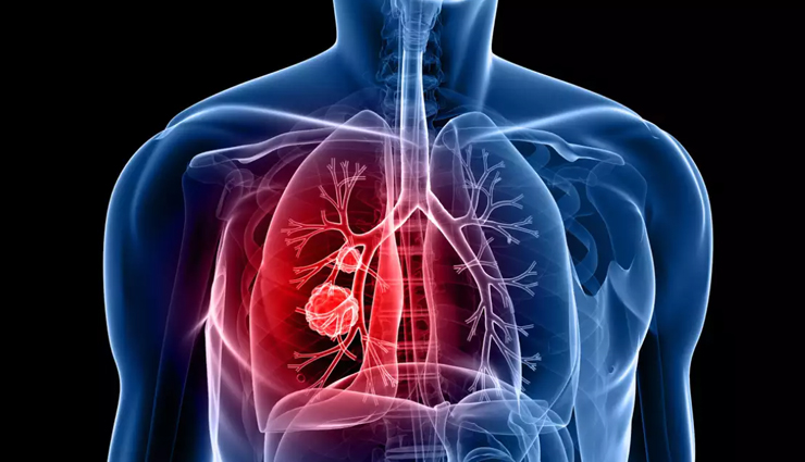 aloo bukhara,health benefits of aloo bukhara,Health tips,fitness tips