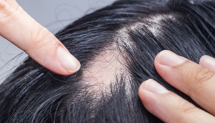 hair growth problems,reasons for slow hair growth,hair growth challenges,preventing hair growth,hair thinning causes,hair loss factors,scalp health and hair growth,nutrition and hair growth,hair care mistakes,stress and hair growth,hormonal imbalance and hair loss,genetics and hair growth,environmental factors and hair health,diet and hair growth,healthy hair tips