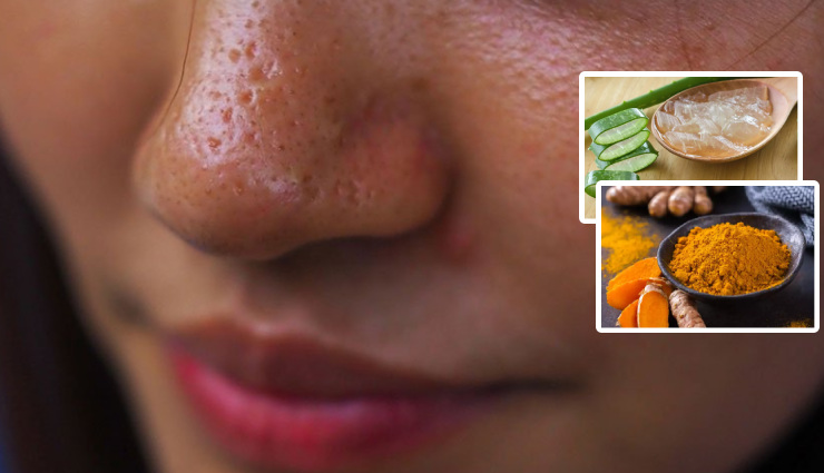 diy face masks,homemade face masks,natural face masks,2 ingredient face masks,glowing skin,healthy skin,skin care,beauty tips,skin problems,blackheads,oily skin,acne,aging,skin tightening,deep cleaning pores,clear skin,brighten skin,reduce dark spots,hydrate skin,exfoliate skin