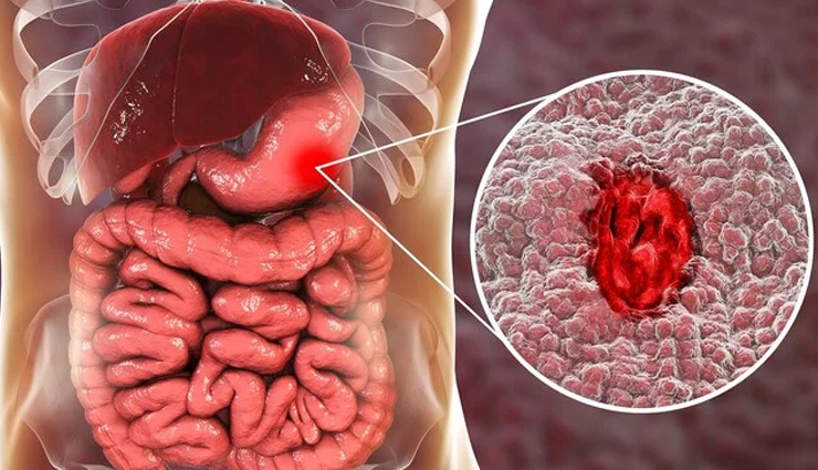 आलस के चक्कर में अगर आप भी खाते है खड़े होकर खाना, तो हो जाए सावधान, ये बीमारियां कर रही हैं आपका इंतजार side effects of standing eating,risks of eating while standing,health impact of standing while eating,standing eating disadvantages,khade hokar khane ke nuksan,khade hokar khana side effects,eating standing up drawbacks,negative effects of standing meals,health hazards of standing meals,standing meal impacts on health,digestive problems while standing,disadvantages of standing meals,negative impacts of standing and eating,standing while eating health risks,khade hokar khane ke side effects,stomach issues while standing eating,health drawbacks of standing meals,eating habits and health effects,standing meal consequences,risks of standing and consuming food
