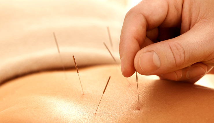 world thyroid day,natural alternatives for hypothyroidism,Health tips,fitness tips,thyroid care tips