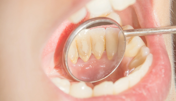 aloe vera,health benefits of aloe vera,Health tips,fitness tips