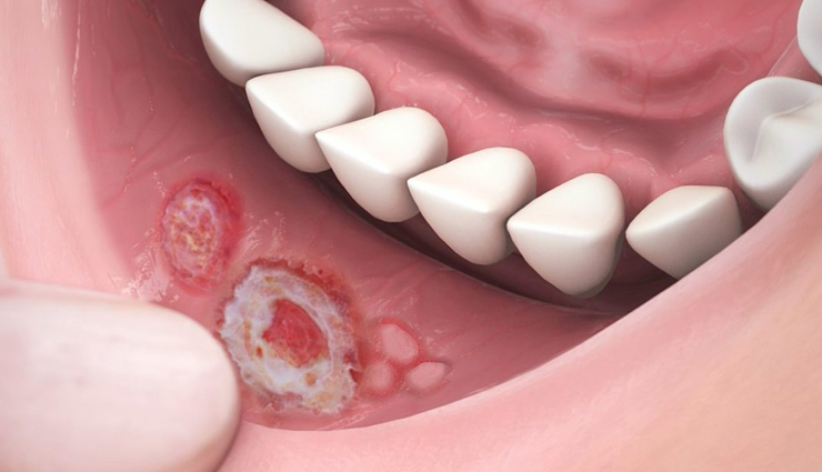 aloe vera,health benefits of aloe vera,Health tips,fitness tips