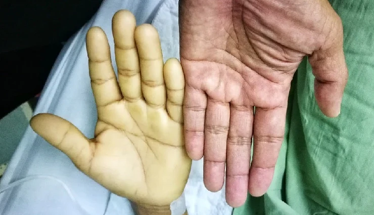 premature grey hair,early greying causes,grey hair in 20s,reasons for grey hair,prevent premature greying,early grey hair treatment,melanin loss hair,grey hair solutions,young age grey hair,hair color loss causes