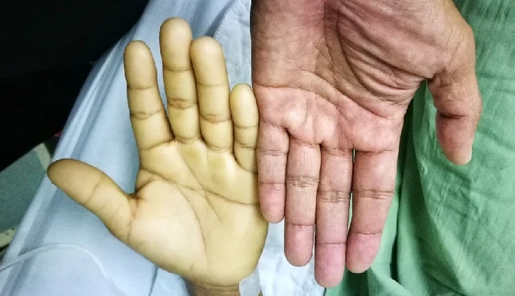 health benefits of pistachios,pistachios nutrition facts,benefits of eating pistachios daily,pistachios for heart health,pistachios for weight loss,pistachios antioxidants benefits,pistachios for skin and hair,pistachios rich in minerals,pistachios healthy snack,pistachios health benefits for adults and children