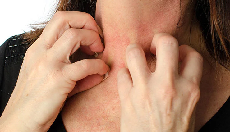 excessive cashew consumption side effects,negative effects of eating too many cashews,harmful consequences of excessive cashew intake,cashew overdose and its side effects,risks and dangers of eating excessive cashews,cashew toxicity and its adverse effects,health hazards of consuming too many cashews,excessive cashew ingestion and its drawbacks,side effects of overindulging in cashews,side effects of eating an excess of cashews