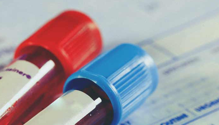 anemia,causes of anemia,Health tips,fitness tips