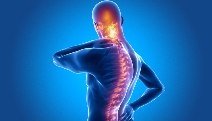 12 Home Remedies To Treat Ankylosing Spondylitis