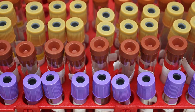 अमेरिकी कंपनी ने तैयार की एंटीबॉडी, कहा - कोरोना वायरस को रोकने में 100% कारगर california,biotech company,found,antibody,coronavirus,cure,covid 19.covid 19 news.health news