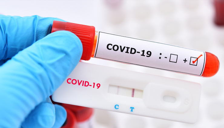 coronavirus,antibody,what is antibody,coronavirus antibody test,covid 19 health updates,health news