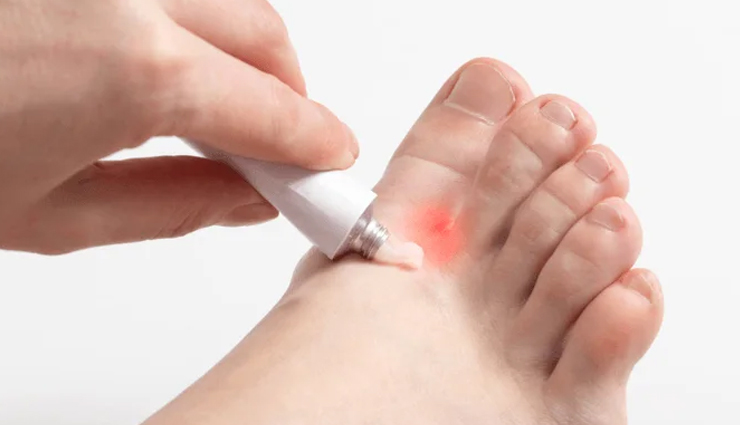 monsoon foot care tips,preventing foot infections during monsoon,keep feet healthy in rainy season,protect feet from monsoon infections,tips to avoid foot infections in monsoon,monsoon foot hygiene guide,prevent fungal infections in rainy season,best practices for foot care in monsoon,avoiding foot problems during rainy season,keep your feet infection-free this monsoon