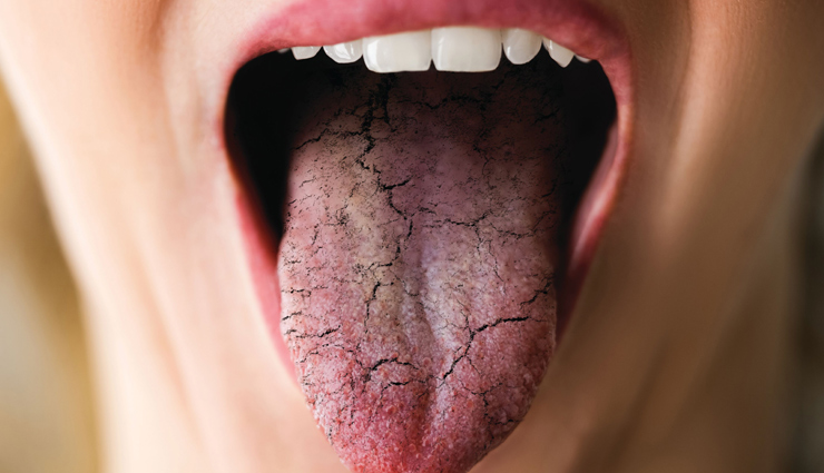 feeling thirsty,feeling thirsty danger sign,Health,healthy living