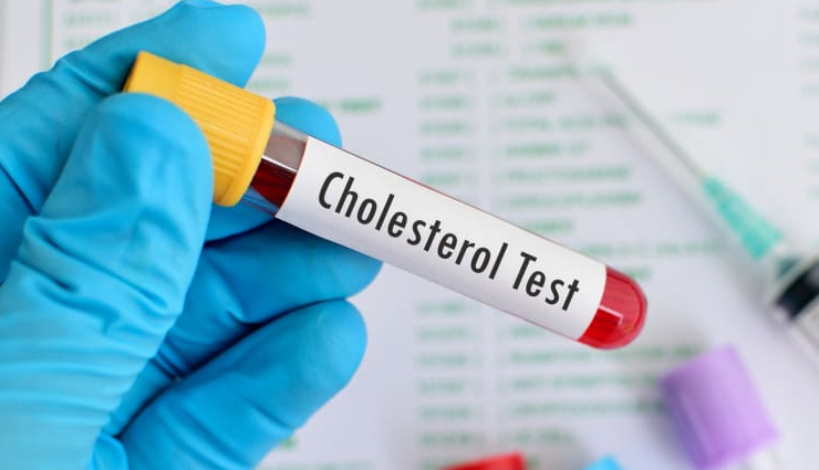 health benefits of apple,Health tips,fitness tips