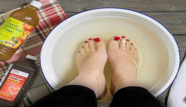 beauty tips,beauty tips in hindi,home remedies,ingrown toenails
