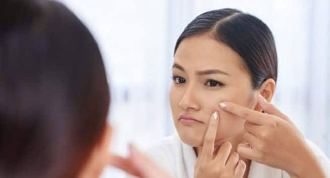 apple cider vinegar,apple cider vinegar for acne,acne care tips,beauty tips,skin care tips