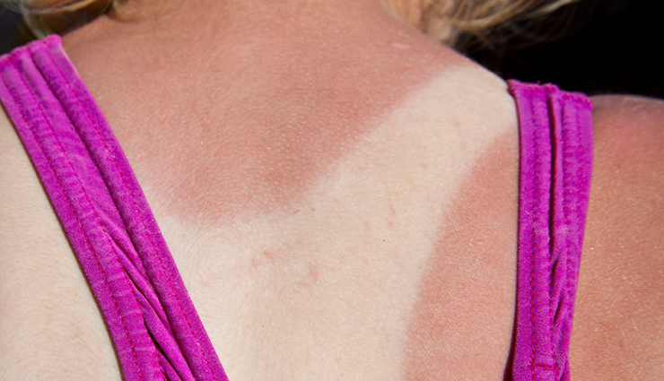 apple cider vinegar,ways to use apple cider vinegar,beauty benefits of apple cider vinegar,beauty tips,skin care tips