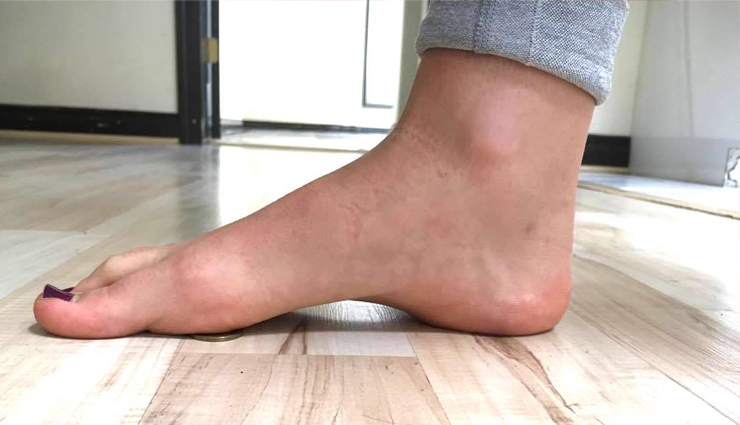 foot pain relief exercises,alleviating foot pain through exercises,effective workouts for foot pain,foot pain management exercises,targeted foot pain relief routines,exercise solutions for painful feet,strengthening exercises for foot pain,relieving foot discomfort through workouts,foot pain alleviation techniques,exercise-based foot pain remedies,flexibility exercises for foot relief,fitness routines for painful feet,foot pain reduction workouts,movement therapy for foot pain,active strategies to combat foot pain