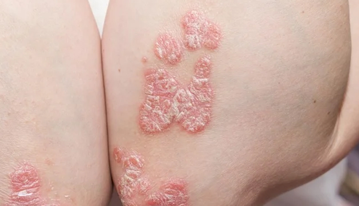 health benefits of argan oil,argan oil for babies,Health tips,fitness tips