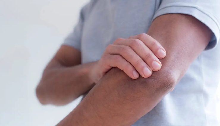 heart attack,myocardial infarction,heart attack symptoms,causes of heart attack,coronary artery blockage,heart attack treatment,heart disease,heart muscle damage,oxygen supply to heart