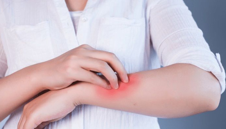 ways to treat your arm pain,home remedies to treat arm pain,healthy living,Health tips,arm pain,getting rid from arm pain