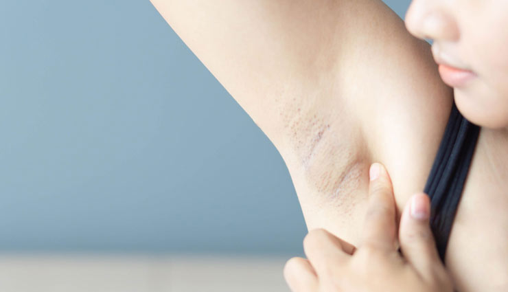 armpit lumps,home remedies for armpit lumps,home remedies,Health tips,fitness tips