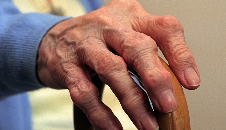 arthritis pain,arthritis pain home remedies,ghatia rog bhagane ke upay,home remedies to treat arthritis pain,health news,healthy living