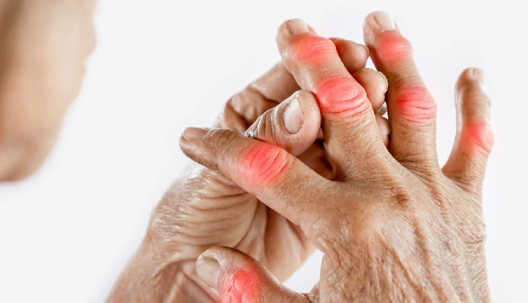 11 DIY Ways To Use Turmeric for Arthritis Treatment