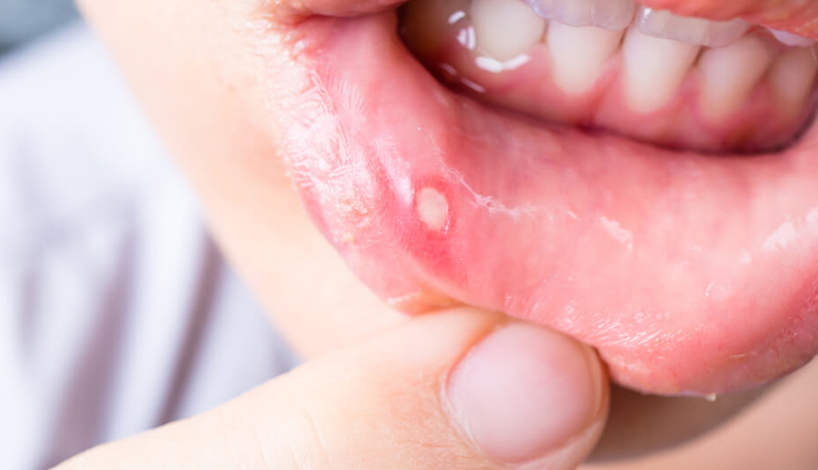 ash gourd,health benefits of ash gourd,Health tips,fitness tips