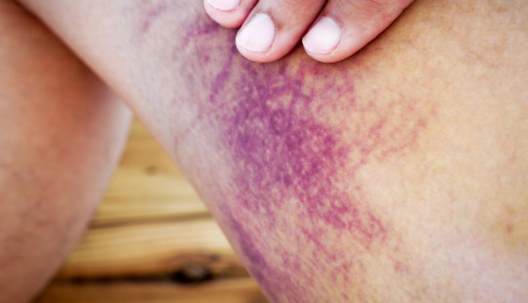 ash gourd,health benefits of ash gourd,Health tips,fitness tips