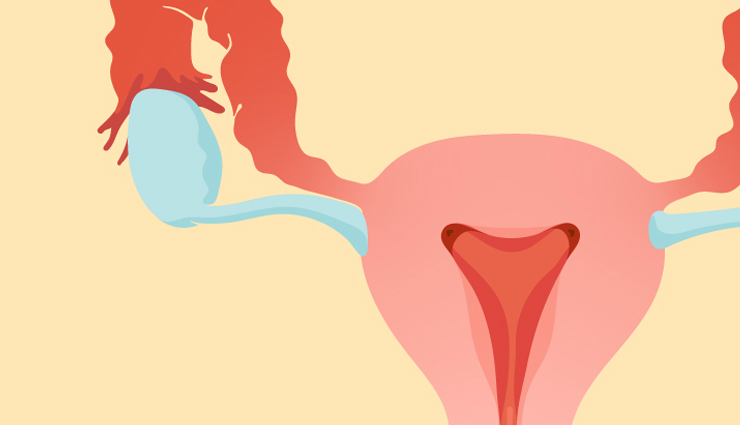 ashokarishta,health benefits of ashokarishta,Health tips,fitness tips