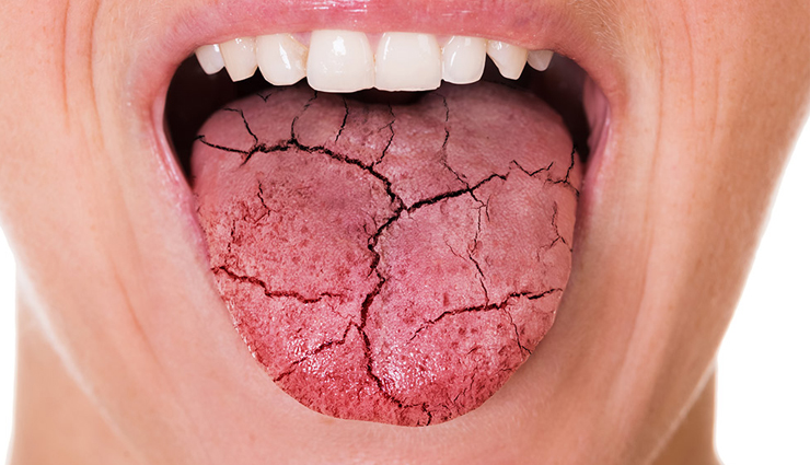 asparagus,side effects of asparagus,Health tips,fitness tips