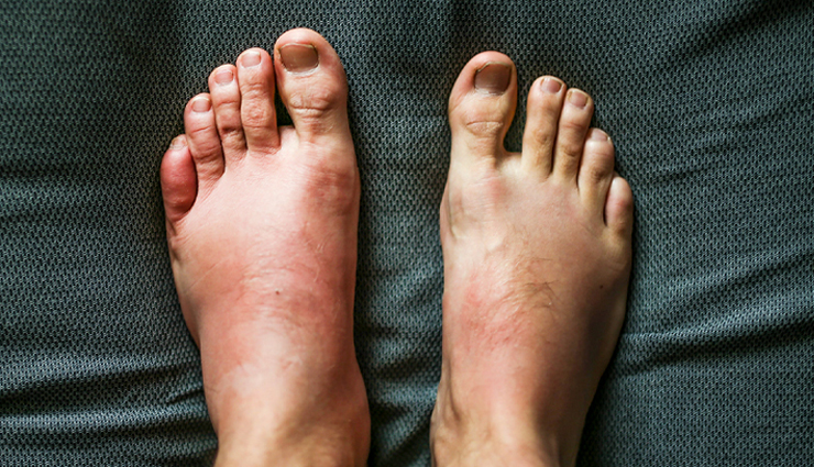 asparagus,side effects of asparagus,Health tips,fitness tips