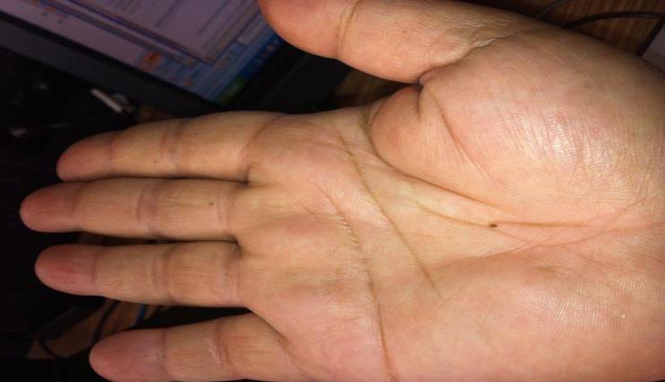 आपकी हथेली पर मौजूद तिल बताता है आपका भाग्य, जाने