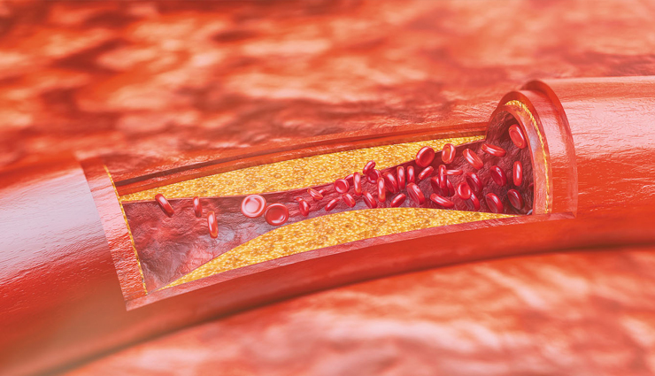 green tea,lemon in green tea,lemon in green tea benefits,health benefits,Health tips