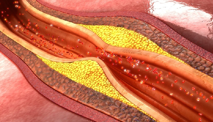 ginger juice health benefits,drinking ginger juice advantages,benefits of ginger juice for health,ginger juice wellness benefits,ginger extract health benefits,ginger root juice advantages,health advantages of drinking ginger juice,ginger juice for immunity,ginger juice for digestion,ginger juice for overall health