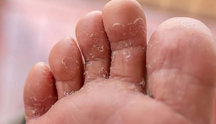 benefits of epsom salt foot soaks,amazing effects of epsom foot baths,how epsom foot soaks improve health,epsom salt foot soak advantages,stress relief with epsom foot soaks,relaxation benefits of epsom foot baths,calming effects of epsom salt foot soaks,epsom foot soaks for relaxation,epsom foot soaks for muscle pain,relief from sore feet with epsom salt,epsom foot baths for muscle relaxation,soothing sore muscles with epsom foot soaks,enhanced circulation with epsom foot soaks,benefits of epsom salt foot baths on blood flow,epsom foot soaks and cardiovascular health,improving circulation with epsom foot baths,epsom foot soaks for foot health,benefits of epsom salt for feet,epsom foot baths and foot care,healthy feet with epsom foot soaks,detoxifying effects of epsom foot soaks,cleansing the body with epsom salt foot baths,epsom foot soaks for body detox,removing toxins with epsom salt foot baths