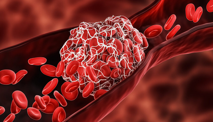 the risk of heart attack increases in winter know the reason and how to take care of heart,Health,healthy living