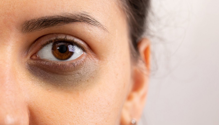 avocado oil,beauty benefits of avocado oil,avocado oil for skin,avocado oil for hair,skin care tips,hair care tips