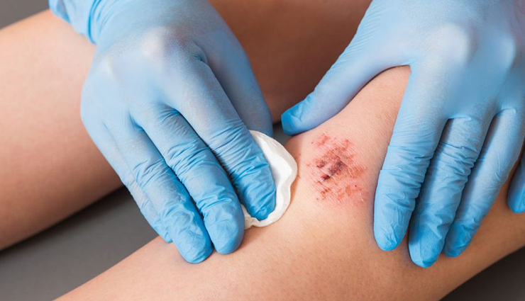 health benefits of avocado oil,avocado oil for skin,avocado oil for hair,avocado oil for heart health,avocado oil nutrition,uses of avocado oil,avocado oil for weight loss,avocado oil for cooking,avocado oil vs olive oil,avocado oil for inflammation,avocado oil benefits for digestion,avocado oil for brain health,best oil for skincare,natural oils for health,avocado oil antioxidants