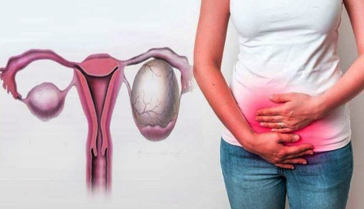 महिलाओं में बढ़ती जा रही हैं बच्चेदानी में सूजन की समस्या, इन घरेलू उपाय से करें इसे दूर 