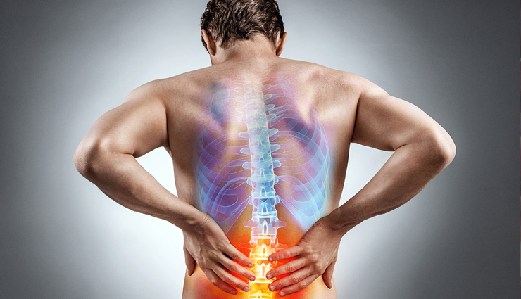 6 Home Remedies That are Effective in Backache