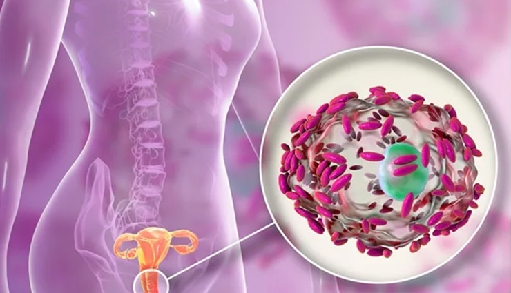 क्यों आती है योनि से सडे़ हुए प्याज की गंध, जानिये इसके कारण और इसे दूर करने के आसान तरीके vagina smells like onions,onion odor vagina,causes of onion smell in vagina,symptoms of vaginal odor,treatment for onion smell in vagina,how to get rid of onion odor in vagina