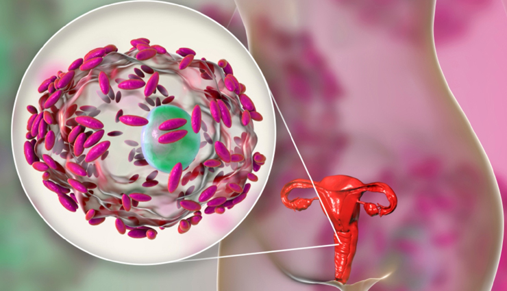 13 Natural Remedies for Bacterial Vaginosis: Effective Ways to Treat BV